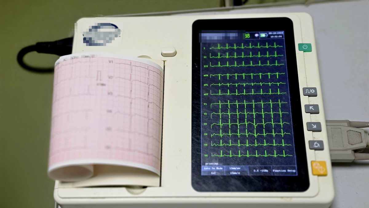 Électrocardiogramme en cours à la Clinique Les Béatitudes, cardiologie à Yassa Douala
