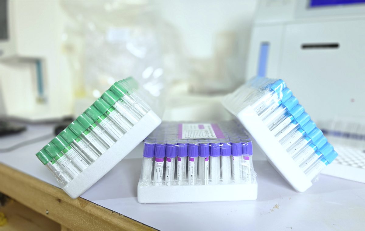 Tubes de prélèvement pour bilan de fertilité, laboratoire de la Clinique Les Béatitudes, Yassa Douala